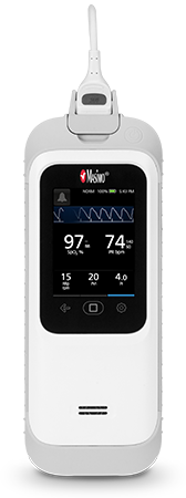 [76-401] Masimo RAD-G Pulsoximeter inkl. Sensor